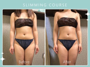 ハノハノ 八代店(HANO HANO)/選べる12種の痩身脂肪撃退☆