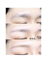 アンフィズム(annfism)/