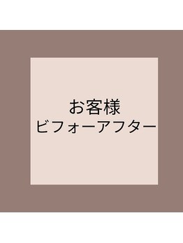 ランティル(l’until)/効果がわかるから続けたい