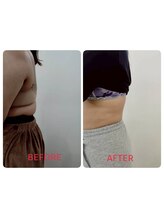 縁(en)/腰の脂肪冷却3回♪