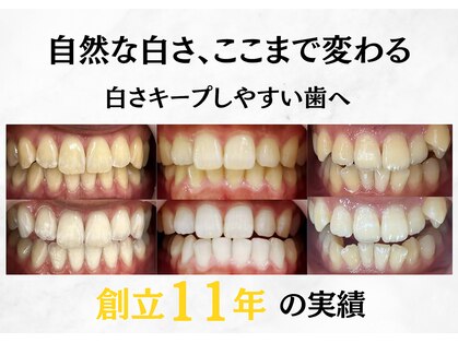 LBSホワイトニング 新宿店の写真