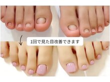 ローネイル(Raw nail)の雰囲気（セルフネイル剥離からの回復経過）