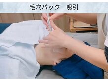 アポロ(Apollo)/【フェイシャル】【メンズ毛穴】