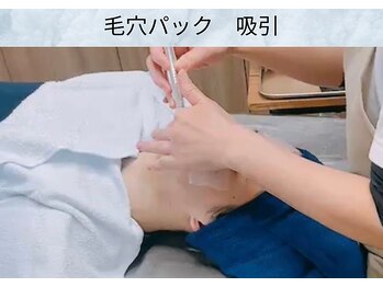 アポロ(Apollo)/【フェイシャル】【メンズ毛穴】