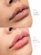 ルボーテ(Re beaute)の写真/隠す黒ずみから、魅せる素肌へ☆黒ずみだけではなく、黒ずみが起こる肌環境を極限に追求!