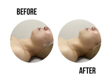 イードット(E.)/お肌のたるみにアプローチ！