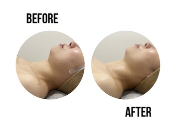 イードット(E.)/お肌のたるみにアプローチ!