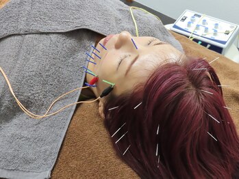 ムイ(mui)/美容鍼☆