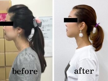 ベレミアム(Bellemium)/10分の奇跡★ネックケア