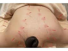 ストリ(STRI)/慢性疲労の方におすすめ！