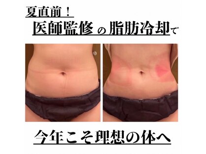 モテスリムの写真