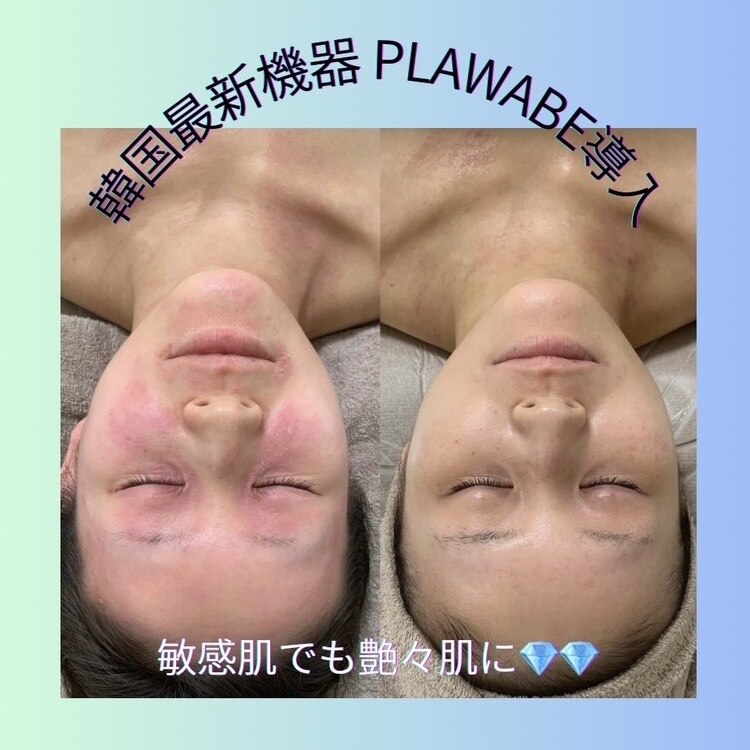 ニコ(25)｜ホットペッパービューティー