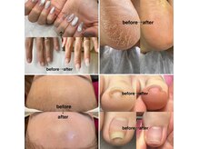 ルクール(Le Coeur)の雰囲気（巻爪、深爪、反り爪などのお悩み解決◎wax、光脱毛も個室で安心）