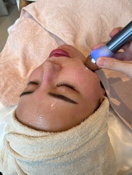 サロン ド ヴェルノ(Salon de VERNO)/【リフトアップ×水分補充】