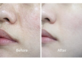 リジュルリジュル(Rigurerigure)/隠さなくていい肌へ