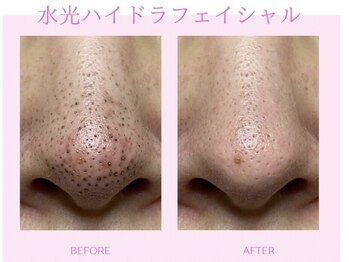 バービーフェイス 恵比寿(Barbie Face)の写真/【春限定ノーファンデ肌】毛穴黒ずみ・開き一掃 水光ツヤ爆誕　鏡を見るのが楽しみになるなめらか肌へ