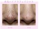 バービーフェイス 恵比寿(Barbie Face)の写真/【春限定ノーファンデ肌】毛穴黒ずみ・開き一掃 水光ツヤ爆誕　鏡を見るのが楽しみになるなめらか肌へ
