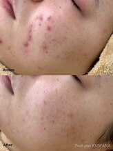 パールプラス 桑名店(Pearl plus)/before / after