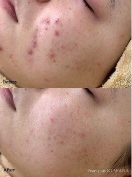 パールプラス 桑名店(Pearl plus)/before / after