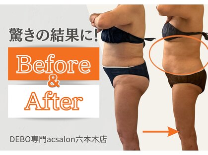 エーシーサロン 六本木店(acsalon)の写真