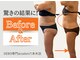 エーシーサロン 六本木店(acsalon)の写真