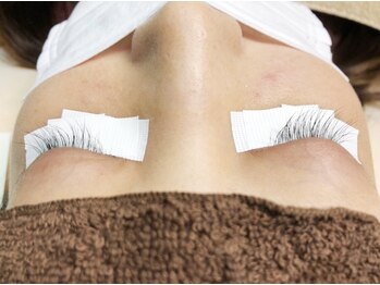 ボディキュア(BODYQA)/セラム使用7ヶ月後