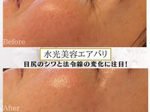 プリンセスフォーの雰囲気（高速ジェットのエアーで有効成分をしっかり浸透！ハリ弾力肌へ♪）