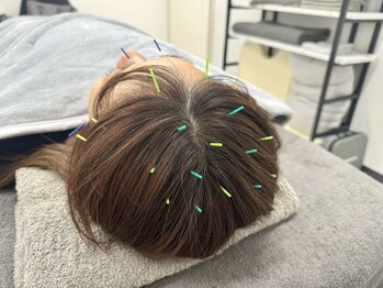 ラフテル鍼灸整骨院/抜け毛ケアに頭皮鍼◎