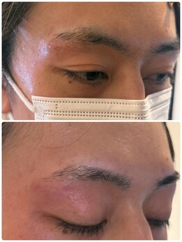 スリーピース(3Peace)/Before/After