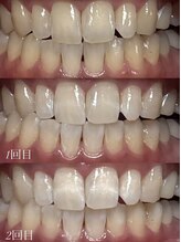 四国健康村 宇多津店/Before after