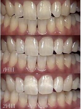 四国健康村 宇多津店/Before after