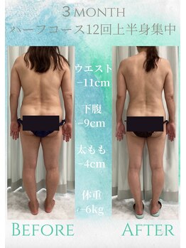 エデン(Eden)/背中　痩身