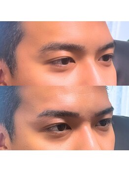 アルデオンワン セカンド(ARDEON.1 second)/【メンズ眉毛】Before/after