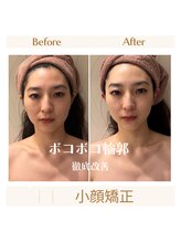 スカーレット 北参道(Scarlett)/Scarlett式小顔矯正