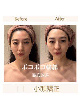 スカーレット 北参道(Scarlett)/Scarlett式小顔矯正