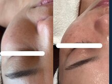 ジョーヌ(JAUNE)/ちりめん皺撃退で若々しい印象へ