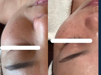 ジョーヌ(JAUNE)/ちりめん皺撃退で若々しい印象へ