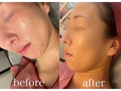 ヴェーラベレッツァ(Vera Bellezza)の写真