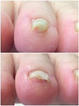 モアクリスタル(More Crystal)/