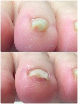 モアクリスタル(More Crystal)/