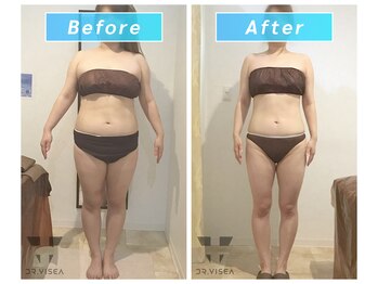 トラレス(Trouless)/