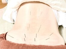 むらかみ鍼灸 マッサージ