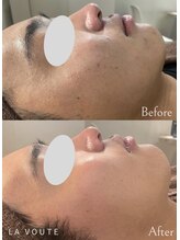 ラボーテ 名古屋店(La voute)/CHRISTINA『アンストレス』