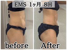 イデアルボーテ/最新EMSでボディメイク