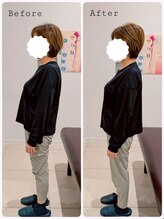 ヒダマリ(HIDAMARI)/姿勢改善ビフォーアフター♪