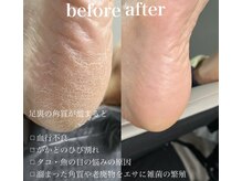 サロン ド ネイル 椿(Salon de nail 椿)/韓国式足裏角質ケア