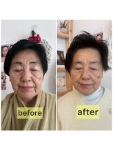 リリースパ 辻堂店(Lily spa)/83歳の方のbefore、after
