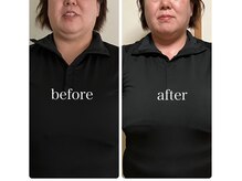 鍼灸庵利央/温活【高濃度水素よもぎ蒸し】