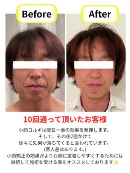 アール(R)/小顔コルギ