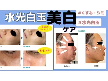 ミライ(Mirai)/水光白玉美白ケア